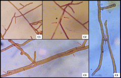 Identification and Characterization of Rhizoctonia Species A